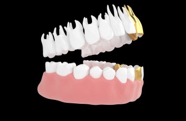 jaw56