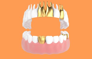 jaw68