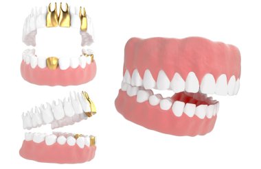 jaw79