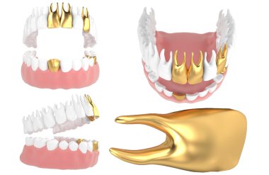 jaw74