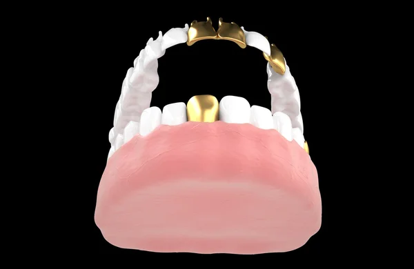 Jaw58b — Stock Photo, Image