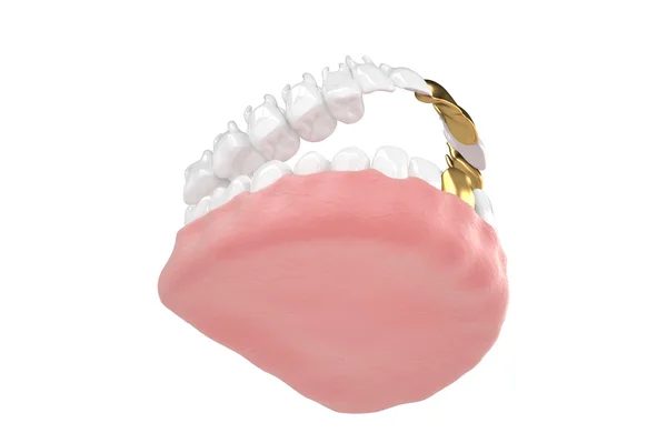 Jaw61 — Stock Photo, Image