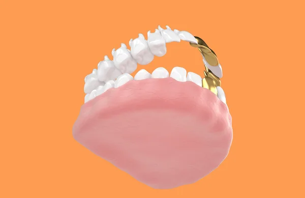 Jaw64 — Stock Photo, Image