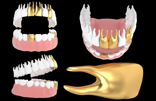 Jaw73 — Stockfoto