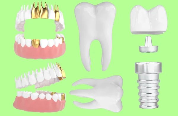 Jaw89 — Zdjęcie stockowe