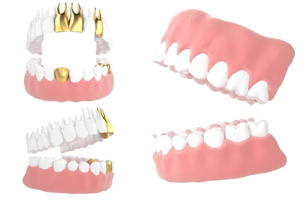 Jaw86 — Stock Photo, Image