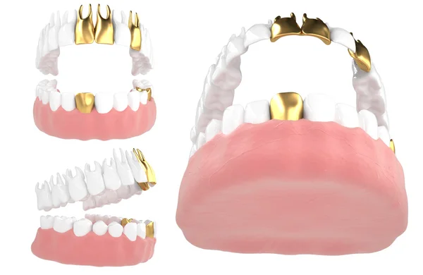 Jaw84 — Stock Photo, Image