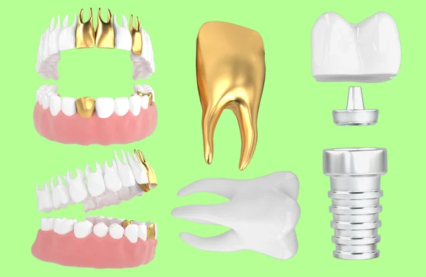 Jaw94 — Zdjęcie stockowe