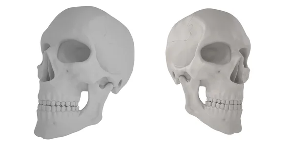 해부학 인간의 scull24 — 스톡 사진