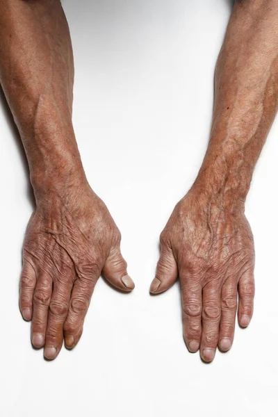 Gerimpelde Handen Van Een Oudere Man Een Tafel Close Geïsoleerd — Stockfoto