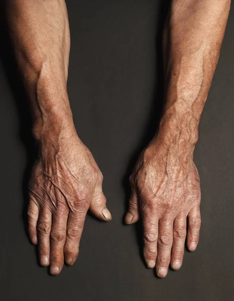 Gerimpelde Handen Van Een Oudere Man Een Tafel Close Geïsoleerd — Stockfoto