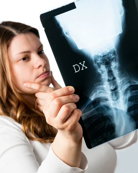 X-ray dari serviks — Stok Foto