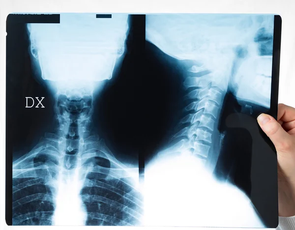 x-ray cervical