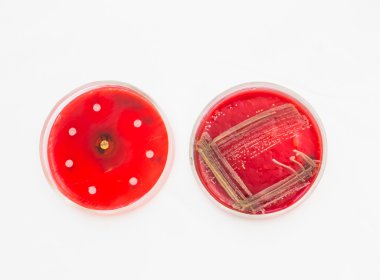 Petri dishes with growing bacteria clipart
