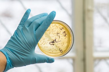 Petri kabına bakteri büyüyen ile