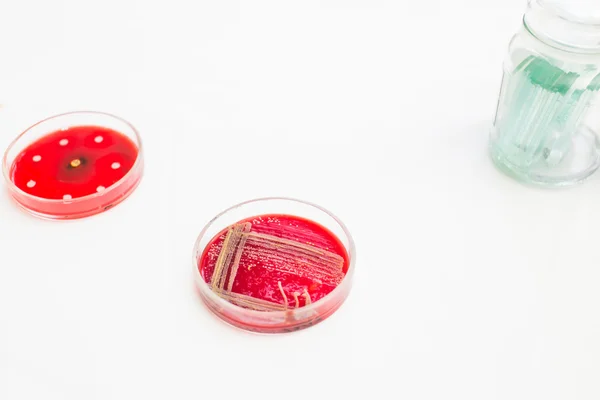 Bakteri büyüyen ile Petri yemekler