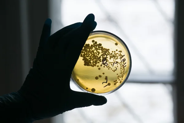 Petri dish with growing bacteria — Stock Photo, Image