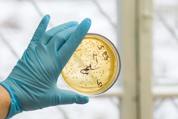 Petri dish with growing bacteria — Stock Photo, Image