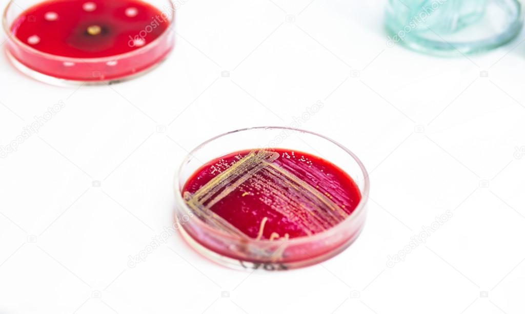 Petri dishes with growing bacteria