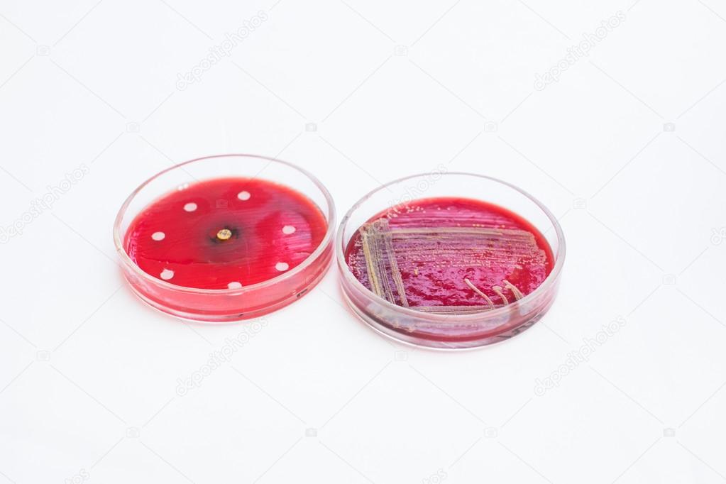 Petri dishes with growing bacteria
