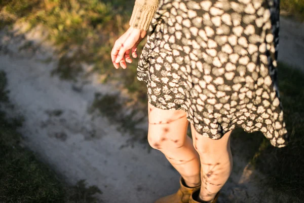 Legs of a young woman — Stock Photo, Image