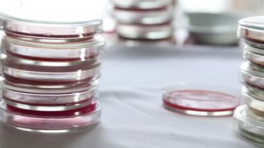 Tıbbi Laboratuar Petri yemeklerinde yığınları