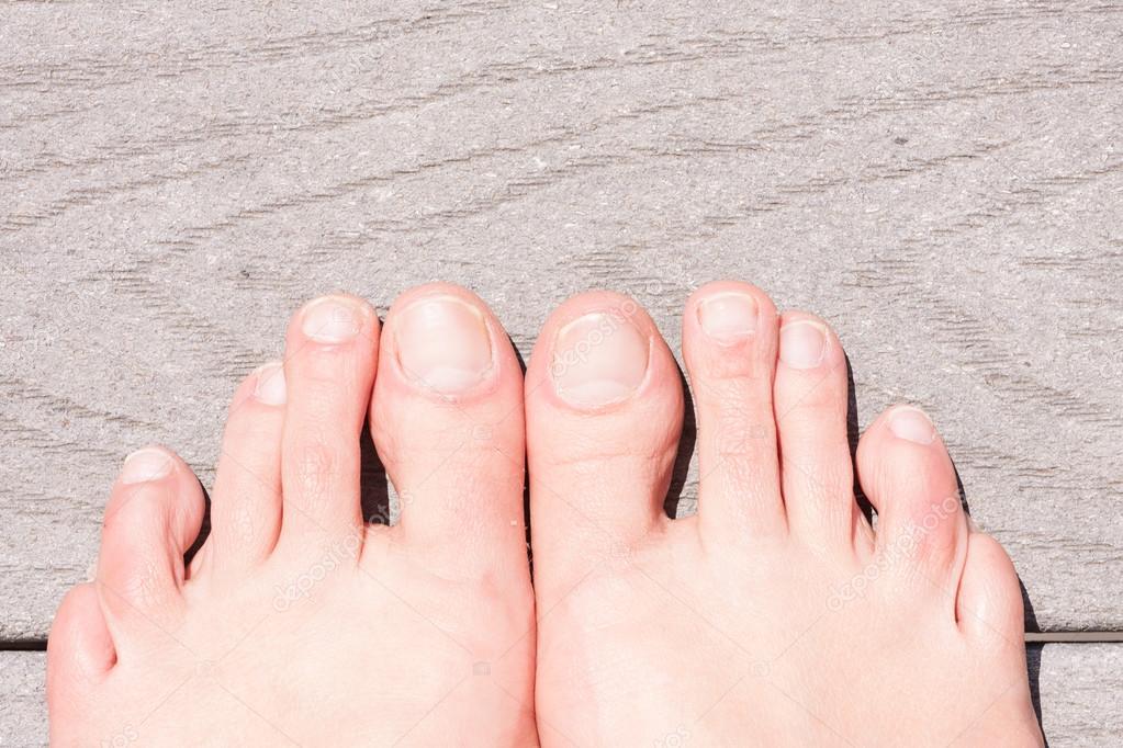 Pics Of Womens Feet