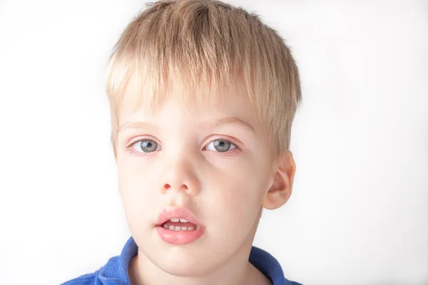 Un retrato de un niño enfermo con nariz que corre y ojos rojos — Foto de Stock