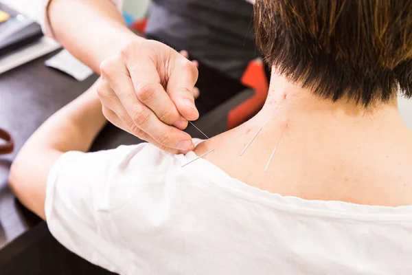 Acupuncteur piquant l'aiguille dans la peau, avec une faible profondeur de champ — Photo