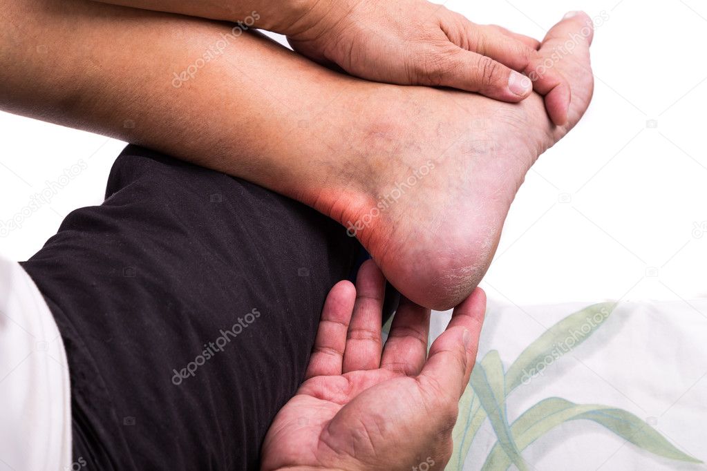 Man with painful inflammation at back of foot