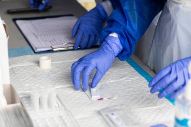 Seri sağlık çalışanları test kiti üzerinde covid-19 numune kültürünü test etmeye hazırlanıyor.