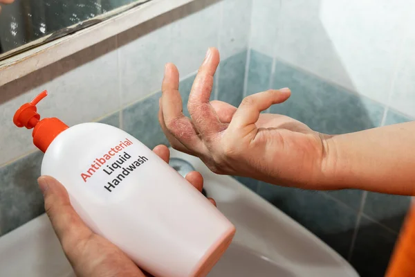 Pele seca no dedo com garrafa de líquido antibacteriano handwash. A lavagem frequente das mãos causa secura da pele — Fotografia de Stock