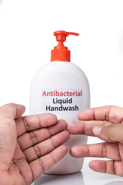 Sucha skóra na palcu z butelką płynu do mycia rąk. Częste mycie rąk powoduje suchość skóry — Zdjęcie stockowe