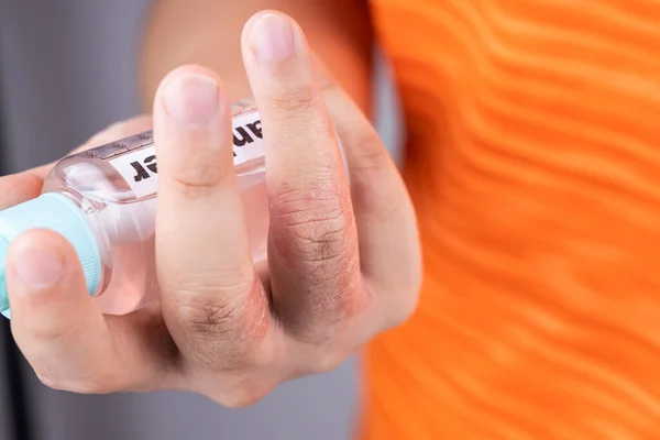 Dedo de piel seca con botella de desinfectante de manos. El desinfectante causa sequedad con uso frecuente — Foto de Stock