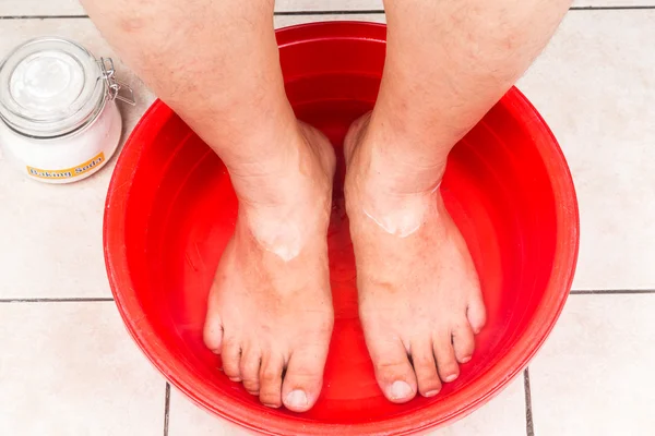 O bicarbonato de sódio é usado como banho de pés em casa . — Fotografia de Stock