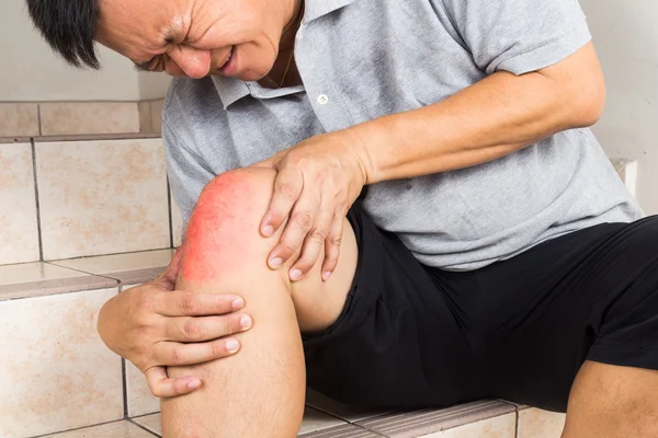 Reifer Mann mit schmerzhaftem Kniegelenk sitzt auf Stufen — Stockfoto