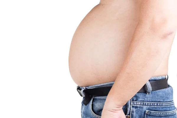Homem obeso com barriga grande saliente insalubre — Fotografia de Stock