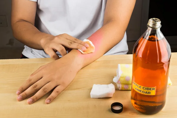 Apple cider vinegar effective natural remedy for skin itch, fung — Stock Photo, Image