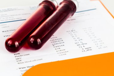 Kan örneğinde rapor eleme sağlık analizi ile test tüpleri