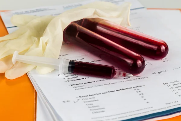 Sampel darah dalam tabung tes dengan laporan pemeriksaan analisis kesehatan — Stok Foto