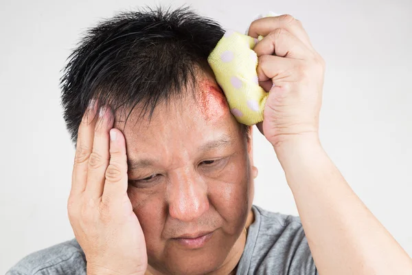 Man behandelen zijn gewonde pijnlijke gezwollen voorhoofd hobbel met icepack — Stockfoto