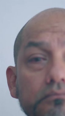 Göz ameliyatının yarısının görüntüsü yavaş yavaş odaklanıyor ve yeni ameliyat edilen gözlerini gösteriyor..