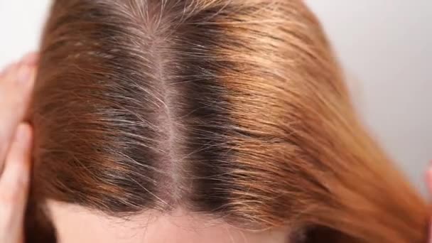 Crecido después de manchar las raíces grises del pelo en la cabeza de una mujer. — Vídeos de Stock