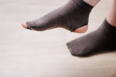 Bacağında eski bir çorap var. Yoksulluk. Yeni kıyafetler alacak param yok..