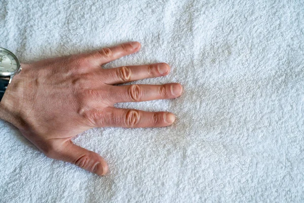 Man hand on a white bed sheet. средства для ухода за кожей. — стоковое фото