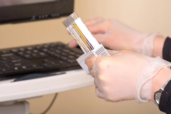 Hastalıkları ve hormonlar kan örnekleri test