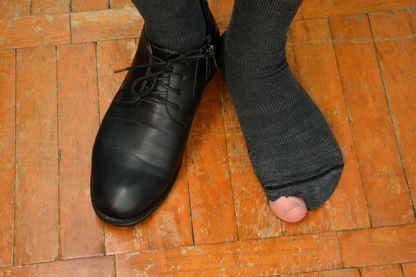 Мужские ноги в одном ботинке и порванный носок . — стоковое фото