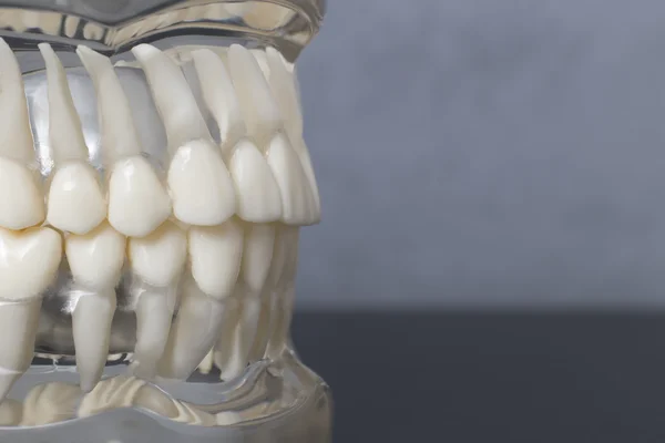 Side close up view of teeth model — Stock Photo, Image