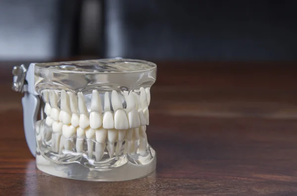 Modello di protesi dentarie con stampo trasparente — Foto Stock