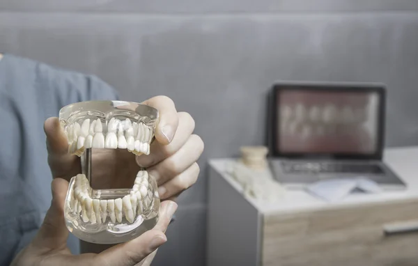 Mostrando un modelo de prótesis dentales —  Fotos de Stock